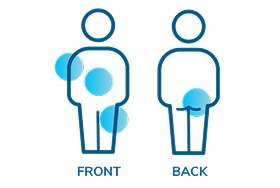 A silhouette of a person indicating areas for injection in the front and back of the body