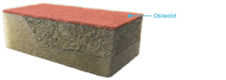 Rectangular cross-section of normal bone with osteoid labeled