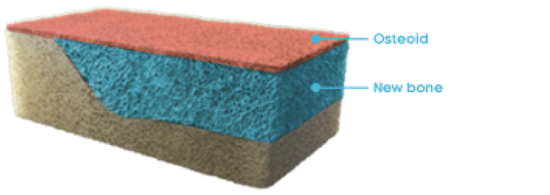 Rectangular cross-section of normal bone with osteoid and new bone labeled