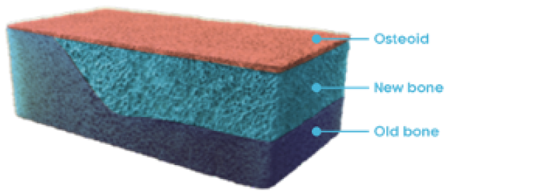 Rectangular cross section of normal bone with osteoid, new bone, and old bone labeled