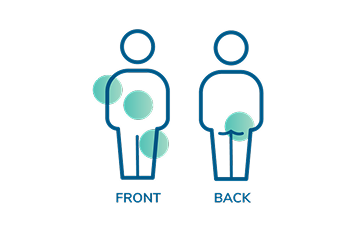 A silhouette of a person in the front and back indicating areas of the body for injection