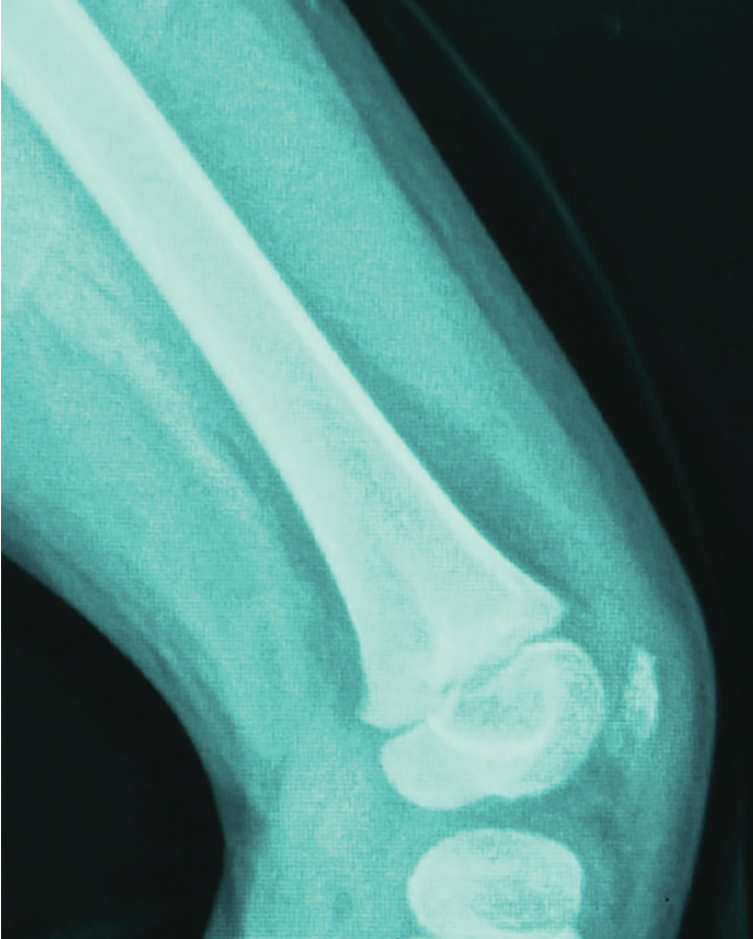 An x-ray image of a knee joint