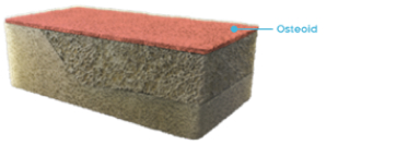 Rectangular cross-section of normal bone with osteoid labeled