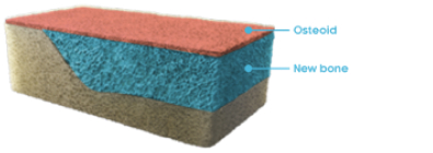 Rectangular cross-section of normal bone with osteoid and new bone labeled