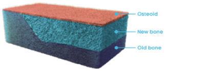 Rectangular cross section of normal bone with osteoid, new bone, and old bone labeled