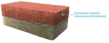 Rectangular cross-section of a bone with osteomalacia with increased osteoid (volume and thickness) labeled