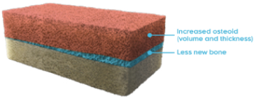 Rectangular cross-section of a bone with osteomalacia with increased osteoid (volume and thickness) and less new bone labeled