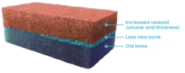 Rectangular cross-section of a bone with osteomalacia with increased osteoid (volume and thickness), less new bone, and old bone labeled